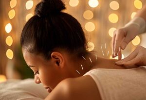 Accupuncture in radstock, bath